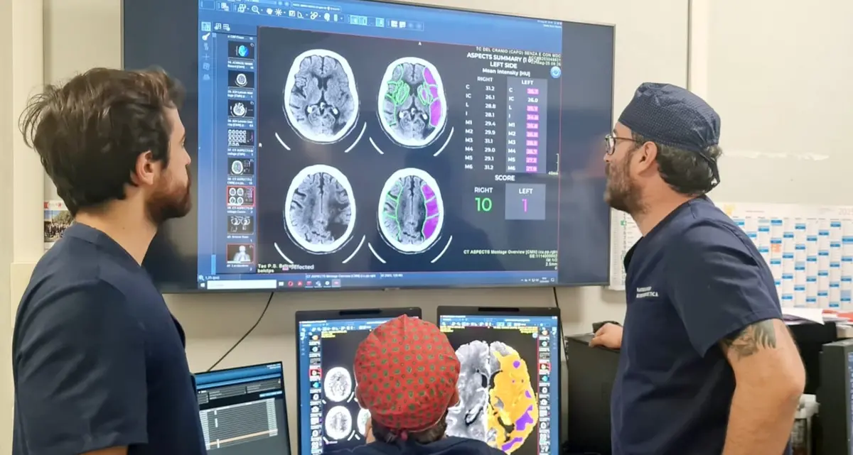 Ictus cerebrale, la diagnosi all’ospedale di Viterbo passa per l’Ai